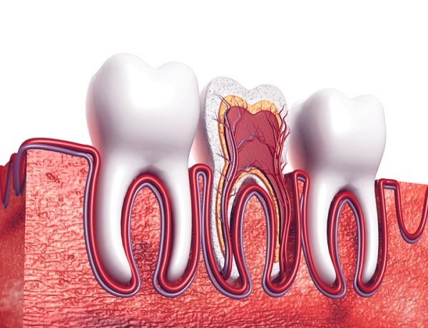 Best Smile Turkey - Tooth root canal treatment